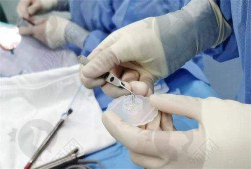 重庆爱尔眼科医院总院的口碑评价