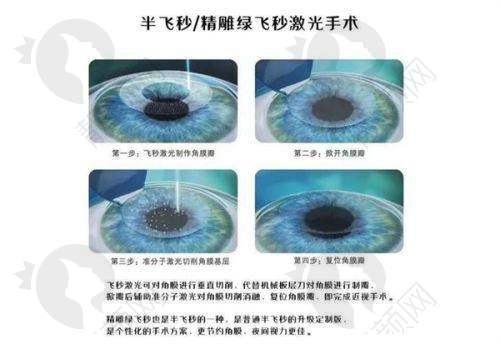 北京华德眼科医院：价格合理，性价比高