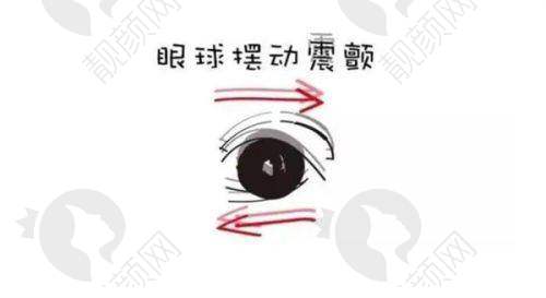 七、南海爱尔眼科医院真实的患者评价如下：