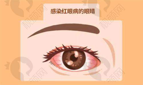 六、南海爱尔眼科医院价格表：（仅供参考）