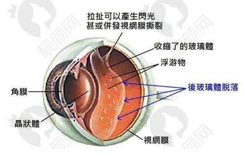 郑州视光眼科医院做近视手术怎么样？贴心服务，全程无忧