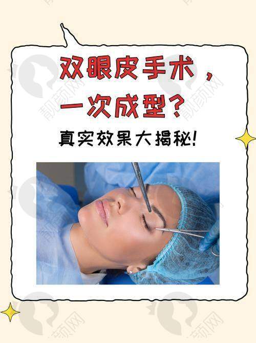 郑州悦容整形医院李戈医生的真实的患者评价如下：