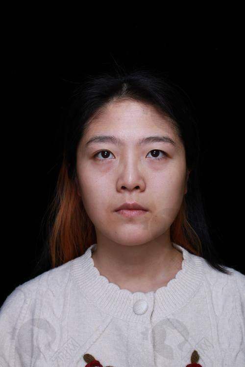 七、杭州健丽（去眼袋）医疗美容诊所真实的患者评价如下：