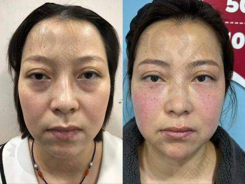 四、杭州健丽（去眼袋）医疗美容诊所基本信息：