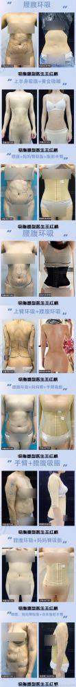 合肥崔劲松医疗美容：资源丰富，服务优质