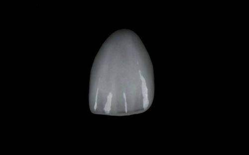 南宁同步口腔：专科特色，个性化牙贴面服务