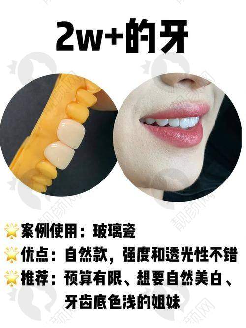 南宁柏乐口腔：多分院连锁，服务贴心价格优