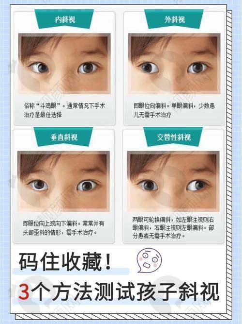 朝聚眼科儿童斜视手术价格之成功实例
