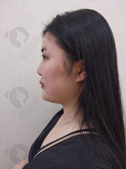 一、深圳宝丽医疗美容门诊部怎么样？