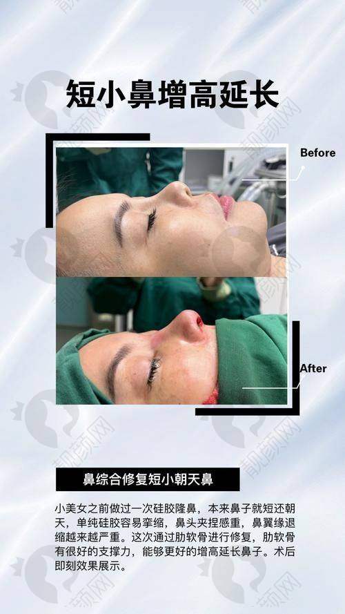 五、深圳宝丽医疗美容门诊部怎么预约：