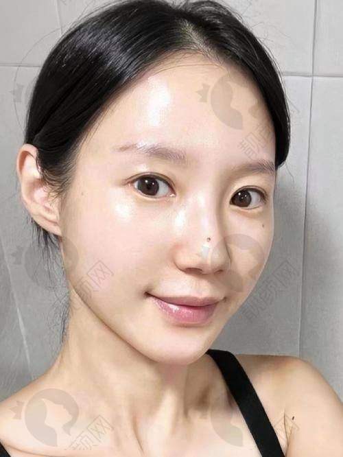 武汉壹加壹整形医院英伦大提升项目优势