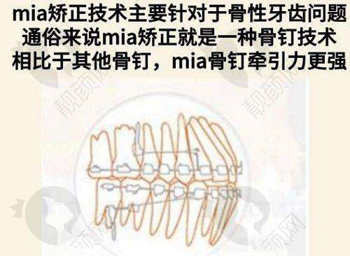 青海润美整形医院——资质正规，特色项目多