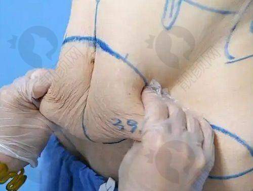 成都高新春天医疗美容院在哪？怎么预约？