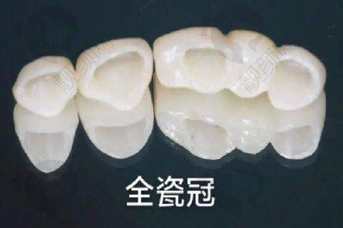 六、上海第九人民医院口腔科价格表：（仅供参考）
