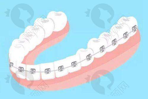 上海雅悦齿科医院:专精骨干医生团队,高难度种植也不怕