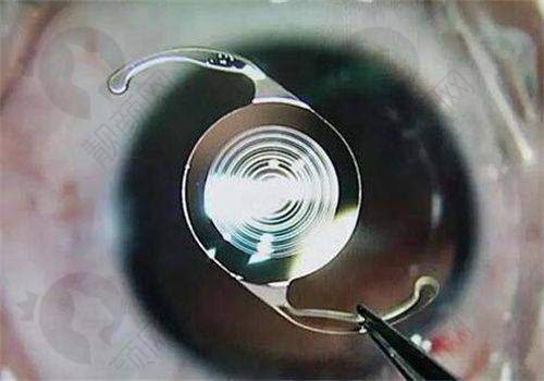 西安市第四 医院眼科：透明合理的价格体系