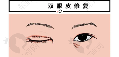 杭州韩美整形可靠医生介绍