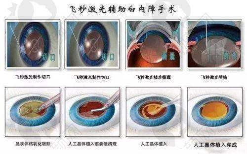 娜楚玻尿酸填充下巴:可达2年的持久美丽