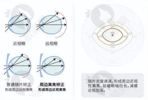 西安市第四 医院眼科：良好的口碑与广泛的认可