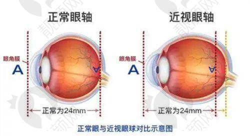 赣州普瑞眼科医院口碑：患者满意度高