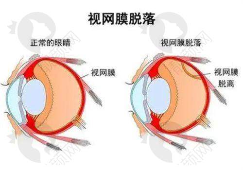 首都医 科 大学附属北京同仁医院（眼科）：历史悠久，技术不错
