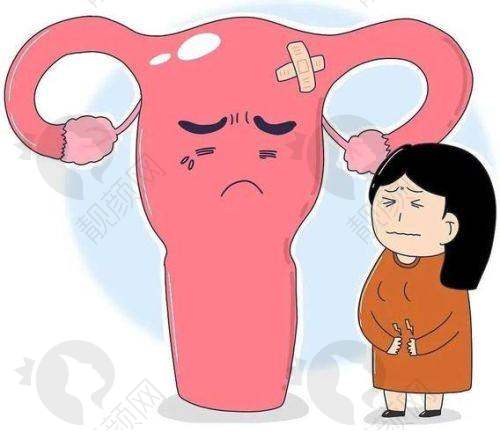 美国viveve缩阴价格大揭秘
