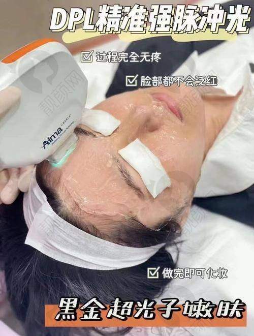 成都润美晶肤医疗美容光子嫩肤真实评价