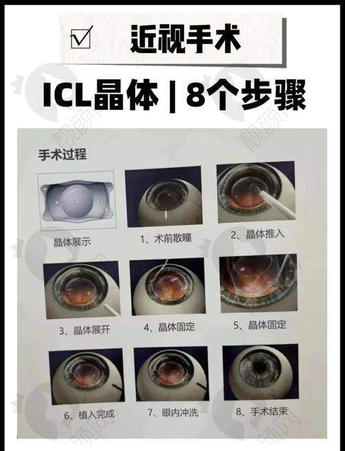 赣州普瑞眼科医院：正规靠谱之选