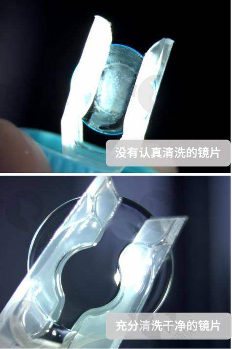 七、北京至亮眼科连锁真实的患者评价如下：