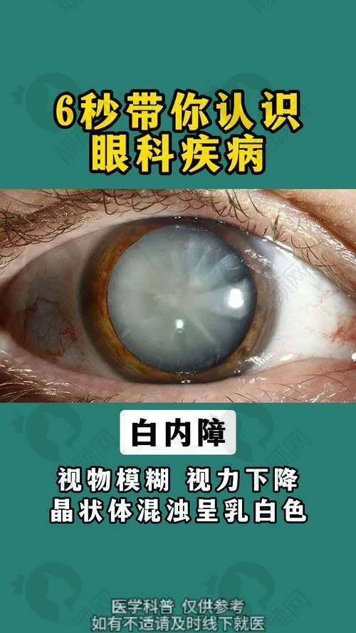 成人后巩膜葡萄肿：病情程度影响大不大？