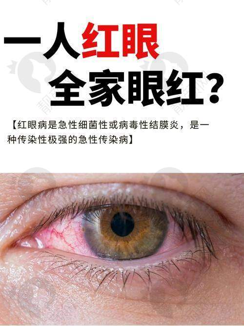 成人后巩膜葡萄肿：治疗方法有哪些？
