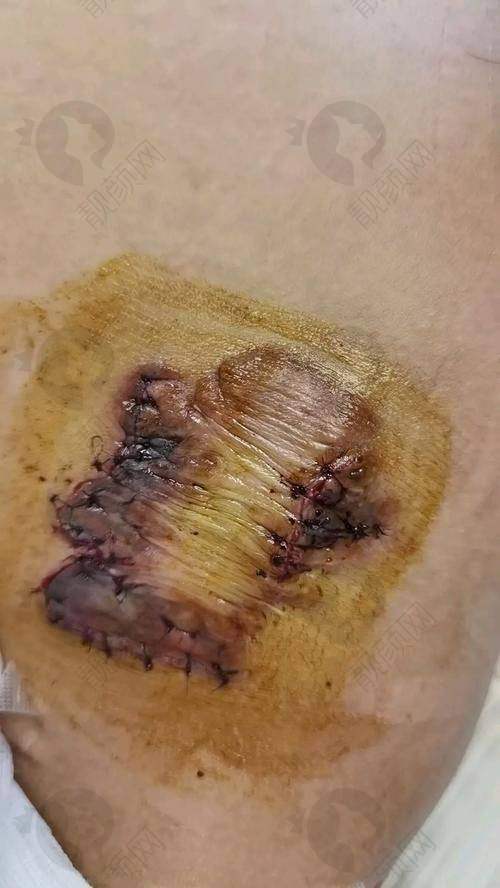 二、苏州乐桥疤痕专科正规吗？来看看医院资质：