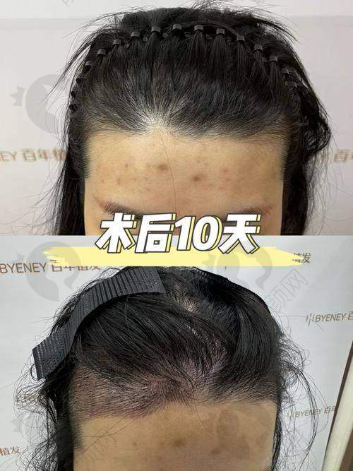 三、南京新生植发医生介绍: