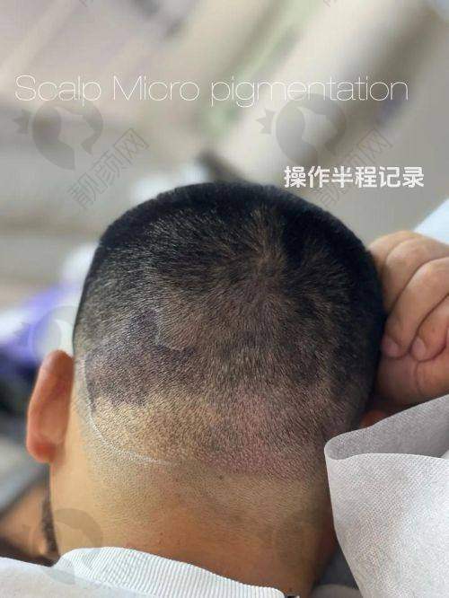 七、南京新生植发真实的患者评价如下：