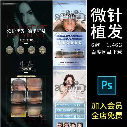 成都植发国内连锁（成都分院）：正规连锁，技术精良