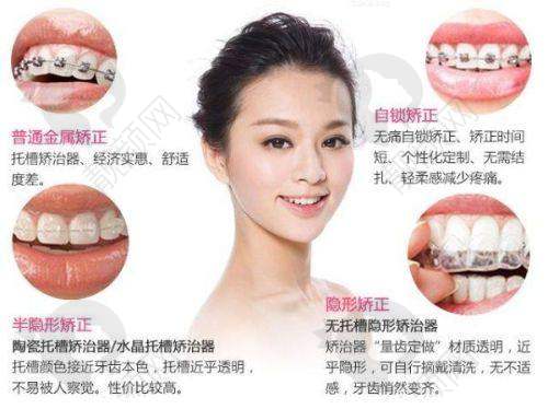 七、重庆涪陵牙博士口腔医院真实的患者评价如下：
