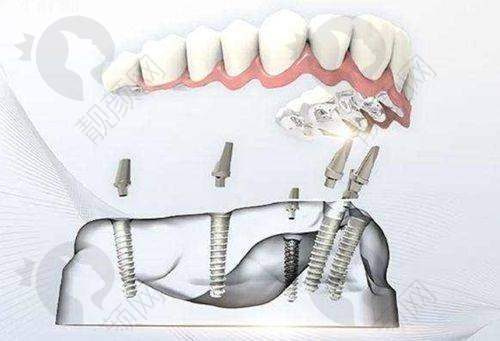 一、重庆涪陵牙博士口腔医院怎么样？