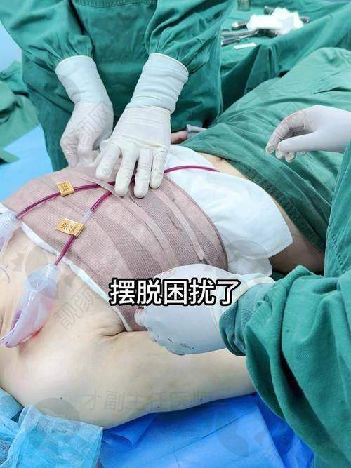 广东省第二人民医院整形美容激光中 心：实力雄厚的三等甲之选