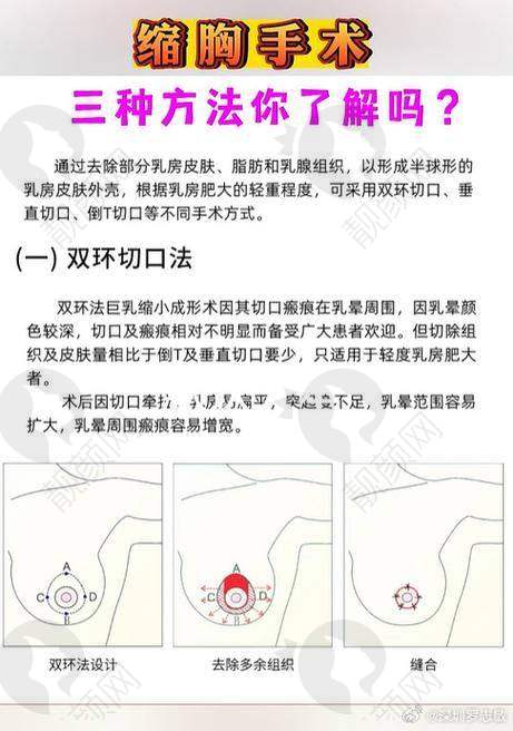广州美恩医疗美容医院：技术与服务双优之选