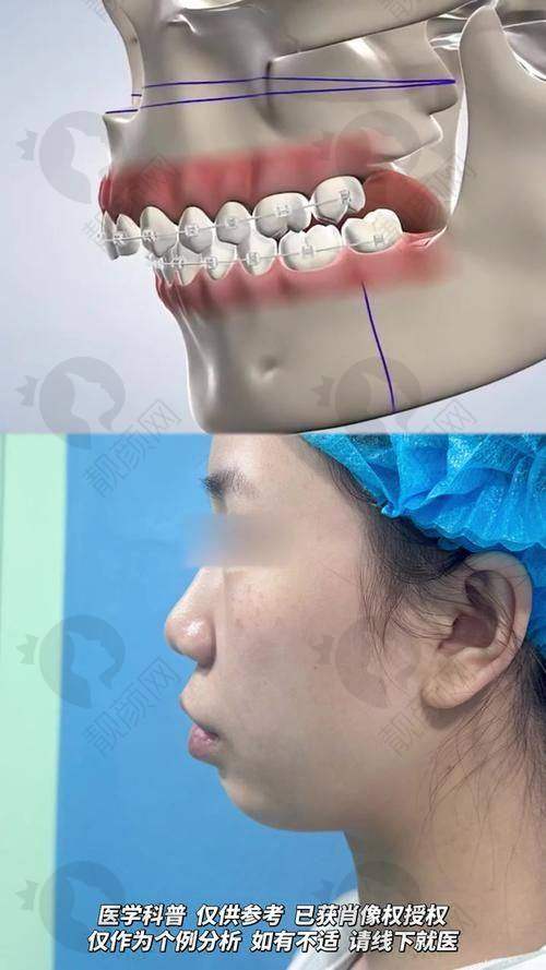 广州广大医院做正颌手术：医院大揭秘