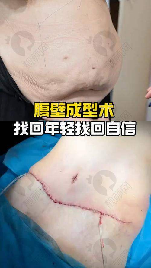 北京嘉禾整形医院：经验多，精细操作