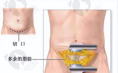 北京美莱医疗美容医院：连锁品牌，吸脂塑形出色