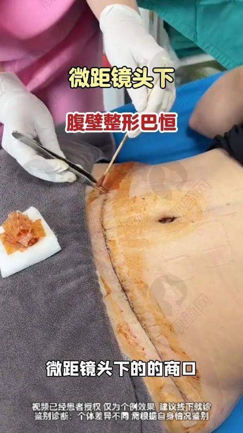 北京华韩医疗美容医院：技术精良，价格合理