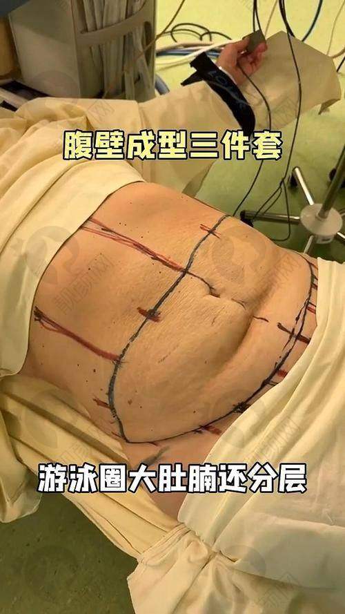 北京华美医疗美容医院：光学监控，结果可控