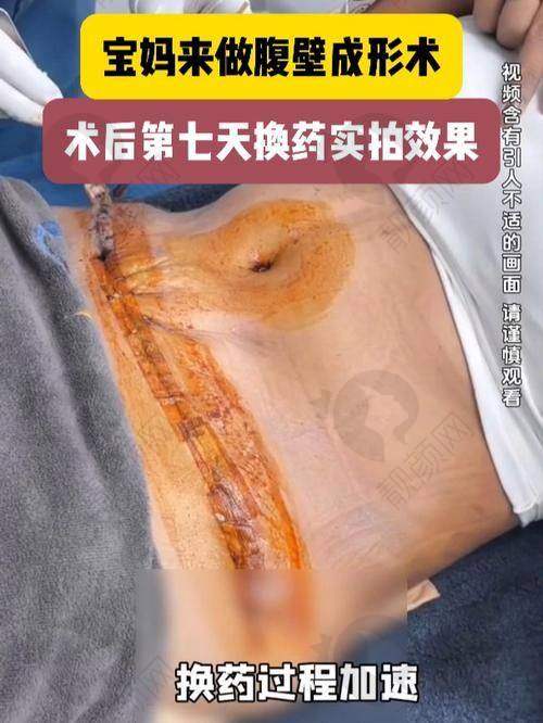 北京友谊医院：综合实力，复杂病例经验足