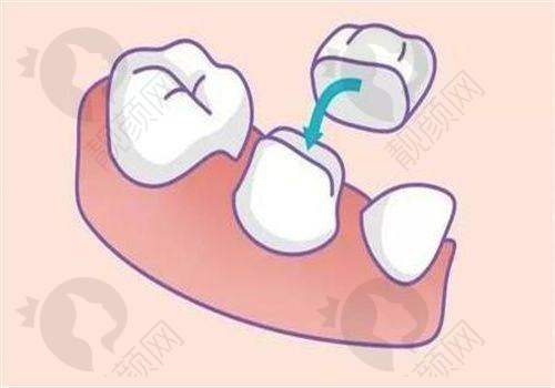 沈阳九诺口腔:个性化服务,定制种植方案