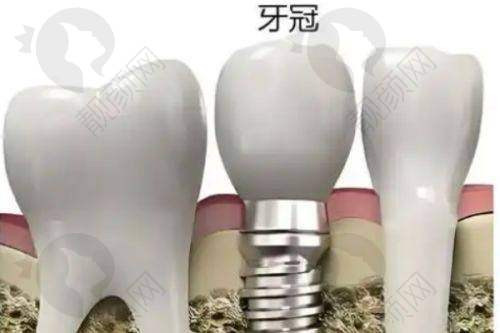 沈阳国睿口腔:团队优异,设备高端