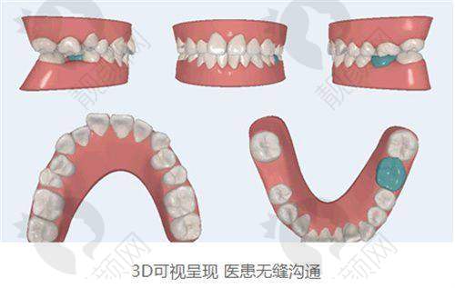 沈阳华领口腔:关注舒适,定期复查