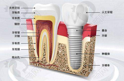 沈阳种植牙排名前十牙科医院汇总：揭秘正规靠谱技术好医院，附地址与口碑评价