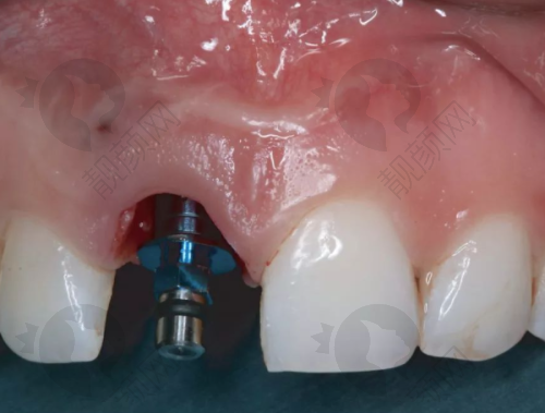 沈阳欢乐口腔医院:3D技术,量身定制